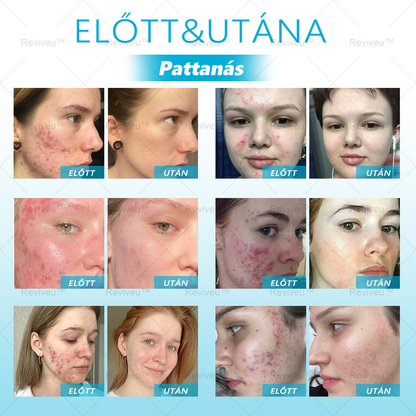 🎉 Korlátozott idejű 50% kedvezmény! 🌟 Búcsúzz el a ráncoktól, és mutasd meg a legszebb éned! 💥 A lehetőség véges, siess és szerezd meg most!