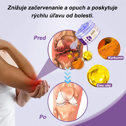 🪻Viloxera™ Kurkuma a Emu Olej Masážny gél proti bolesti kĺbov👨‍⚕️Schválené Slovenskou ortopedickou spoločnosťou (SOTS)