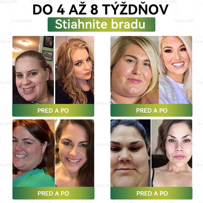 🎉 Gratulujeme! Dnes ste jednou zo šťastných zákazníčok. 🎁 Ako špeciálny darček získavate extra 50 % zľavu! Začnite už dnes s CrazyLeaf® a vykročte k zdravšiemu a krajšiemu životu. 🌿✨