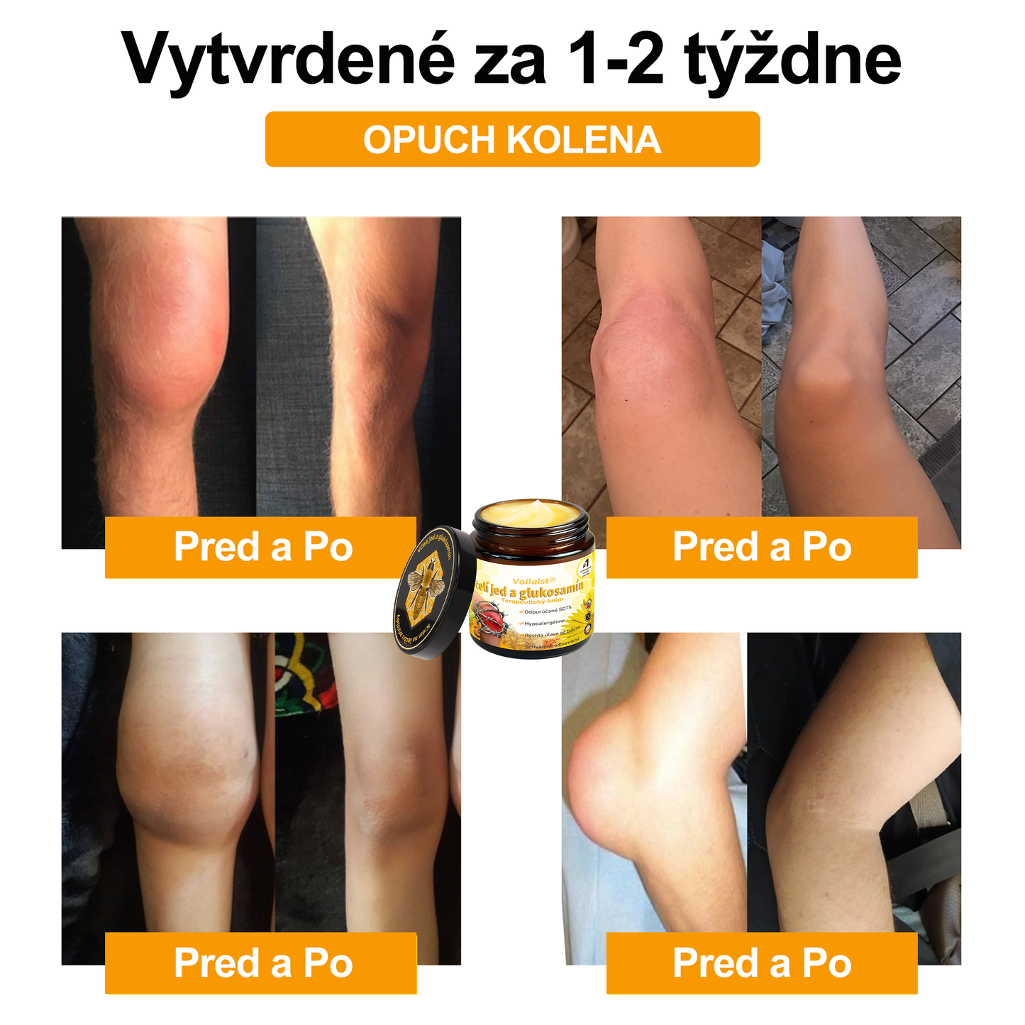 Voilaist® Terapeutický krém s včelím jedom a glukozamínom(Určené pre ľudí v strednom a staršom veku)