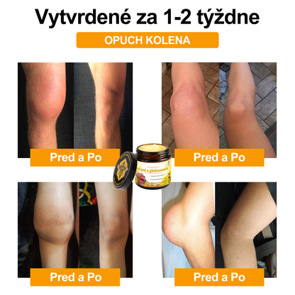 Voilaist® Terapeutický krém s včelím jedom a glukozamínom(Určené pre ľudí v strednom a staršom veku)