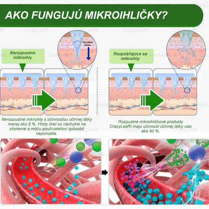 🎉 Gratulujeme! Dnes ste jednou zo šťastných zákazníčok. 🎁 Ako špeciálny darček získavate extra 50 % zľavu! Začnite už dnes s CrazyLeaf® a vykročte k zdravšiemu a krajšiemu životu. 🌿✨