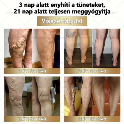 🏆 ÉrMester™  Természetes Vénás Javító Lábfürdő Gélgolyók