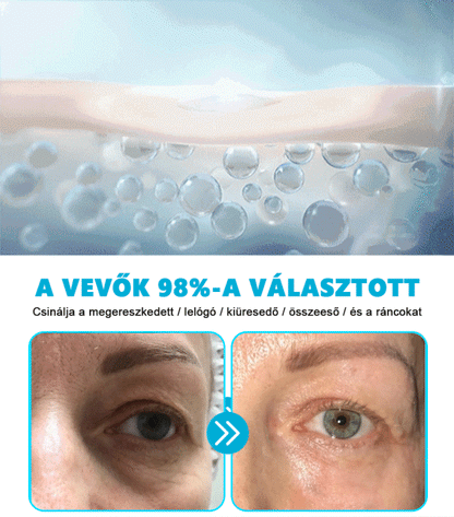 🎉 Korlátozott idejű 50% kedvezmény! 🌟 Búcsúzz el a ráncoktól, és mutasd meg a legszebb éned! 💥 A lehetőség véges, siess és szerezd meg most!