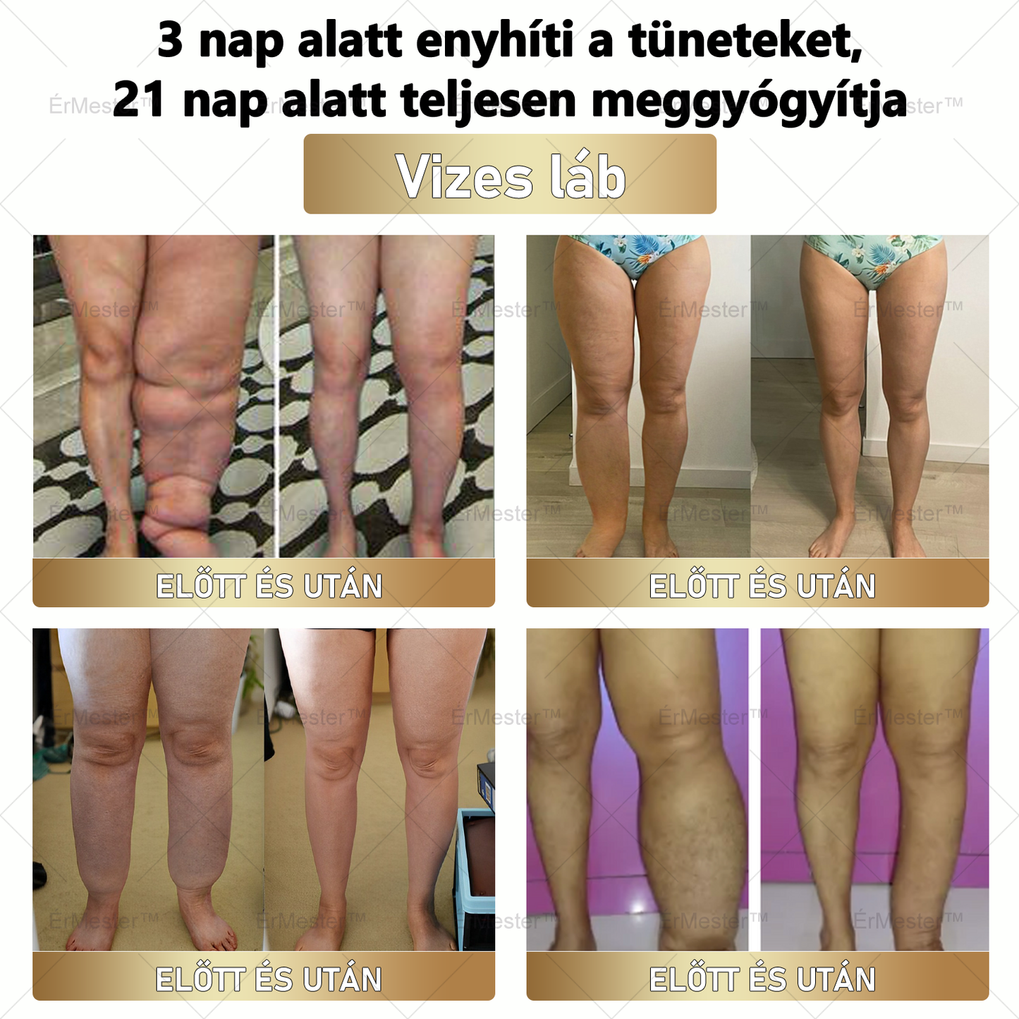 🏆 ÉrMester™  Természetes Vénás Javító Lábfürdő Gélgolyók