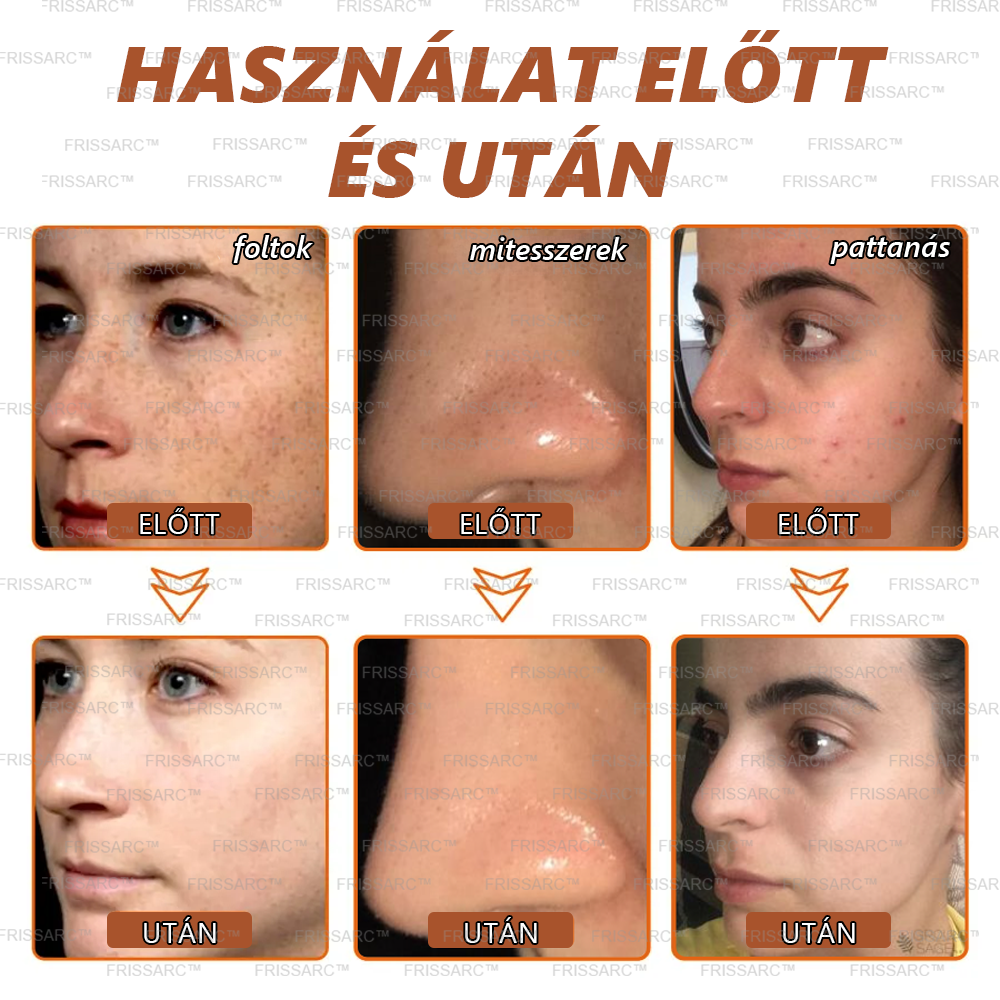 💥 FRISSARC™ Fehérítő és Pigmentfolt Eltávolító Maszk（🔥Búcsúzz el a pigmentfoltoktól, élvezd a sima, tökéletes bőrt! 🔥）