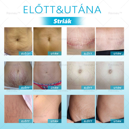 🎉 Korlátozott idejű 50% kedvezmény! 🌟 Búcsúzz el a ráncoktól, és mutasd meg a legszebb éned! 💥 A lehetőség véges, siess és szerezd meg most!