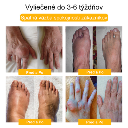 🏆【Oficiálny značkový obchod】𝐀𝐫𝐭𝐫𝐨𝐅𝐥𝐞𝐱𝐢𝐬™ 𝐊𝐫é𝐦 𝐧𝐚 𝐫𝐞𝐠𝐞𝐧𝐞𝐫á𝐜𝐢𝐮 𝐤ĺ𝐛𝐨𝐯 𝐬 𝐯č𝐞𝐥í𝐦 𝐣𝐞𝐝𝐨𝐦(Extrakt z novozélandského včelieho jedu - špecializovaný na ortopedické ochorenia - Certifikovaný CE)