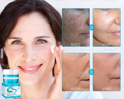 💗💗Reviveu™ Revitalizáló Krém(Jelentős javulás 7 napon belül💯)