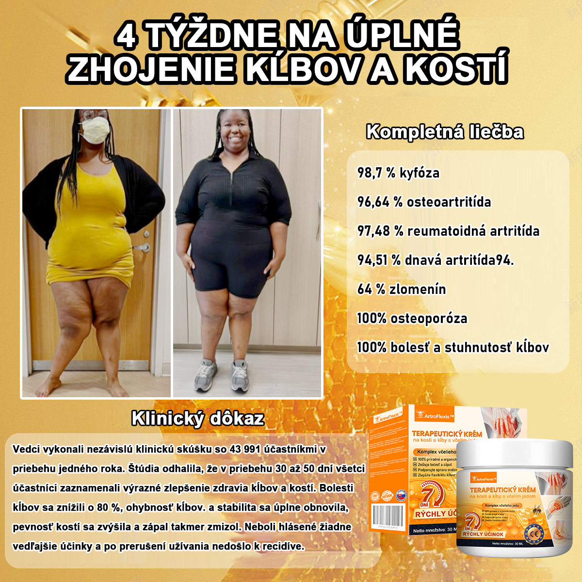 🏆【Oficiálny značkový obchod】𝐀𝐫𝐭𝐫𝐨𝐅𝐥𝐞𝐱𝐢𝐬™ 𝐊𝐫é𝐦 𝐧𝐚 𝐫𝐞𝐠𝐞𝐧𝐞𝐫á𝐜𝐢𝐮 𝐤ĺ𝐛𝐨𝐯 𝐬 𝐯č𝐞𝐥í𝐦 𝐣𝐞𝐝𝐨𝐦(Extrakt z novozélandského včelieho jedu - špecializovaný na ortopedické ochorenia - Certifikovaný CE)