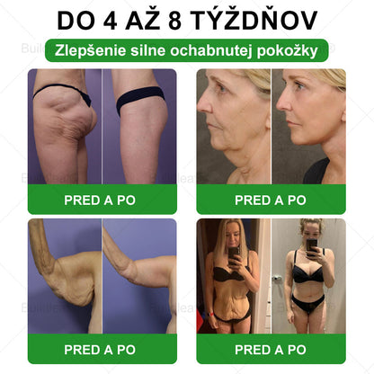 ✨BuildLeaf® GLP-1 6-v-1 Health Solution Perorálna tekutina (Len raz denne, viditeľné zmeny už za 7 dní) Pre obezitu, kardiovaskulárne ochorenia, cukrovku, spánkové apnoe, zdravie čriev, problémy s kĺbmi a ďalšie