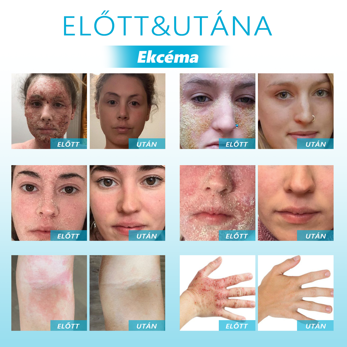 🎉 Korlátozott idejű 50% kedvezmény! 🌟 Búcsúzz el a ráncoktól, és mutasd meg a legszebb éned! 💥 A lehetőség véges, siess és szerezd meg most!