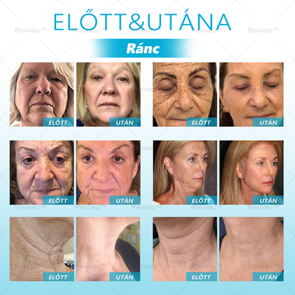 ⏳ Vásárlási visszaszámlálás! 50% kedvezmény, feszes bőr, sima ráncok, újra definiálva a szépséged! 💥 Ne hagyd ki!