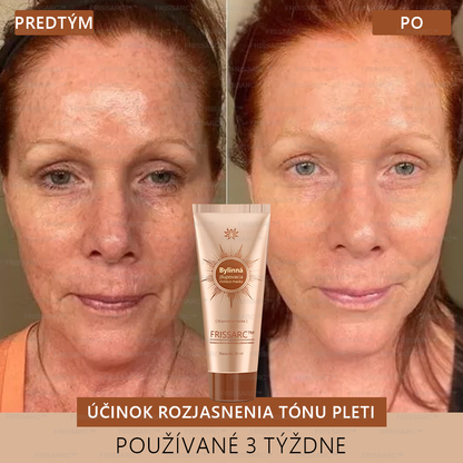 FRISSARC™ bieliaca a škvrny odstraňujúca pleťová maska – Prírodné zložky trvalo odstraňujú pigmentové škvrny, starecké škvrny, pehy a slnečné škvrny.