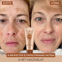 💟FRISSARC™ fehérítő és folteltávolító arcmaszk