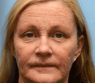 ⏳ Vásárlási visszaszámlálás! 50% kedvezmény, feszes bőr, sima ráncok, újra definiálva a szépséged! 💥 Ne hagyd ki!